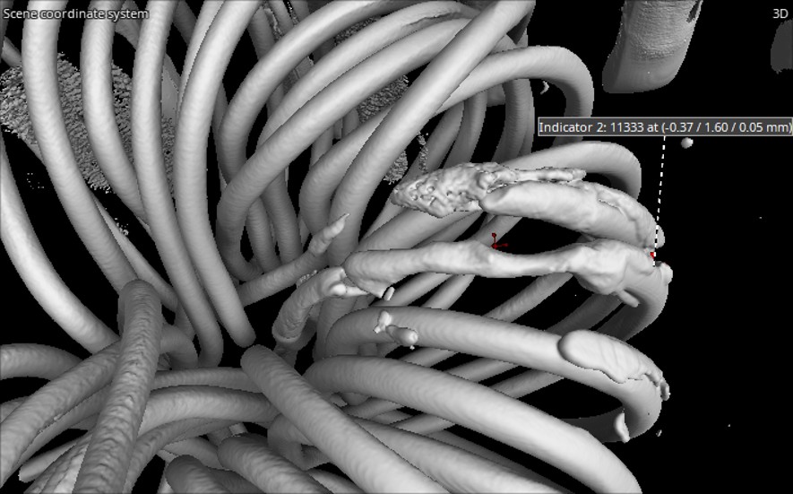 3D CT reconstruction of a coil assembly with dimensional measurement indicators